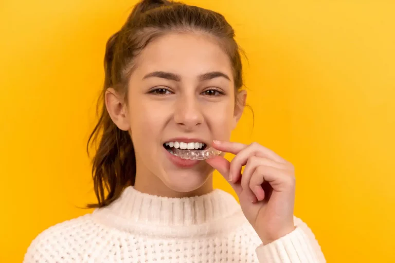 corriger les dents tordues smile clinic orthodontie facettes dentaires