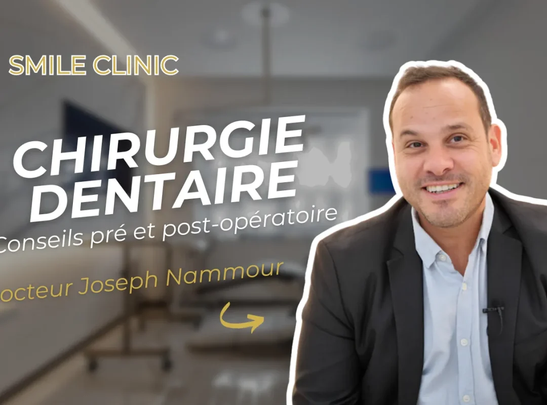 Chirurgie dentaire conseils operation
