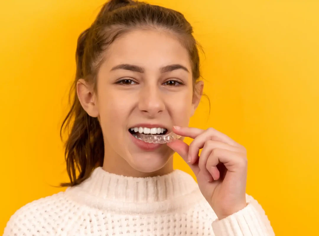 corriger les dents tordues smile clinic orthodontie facettes dentaires