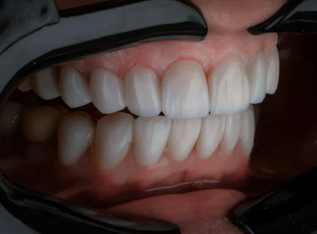 kamal-hoseinianzade-s5TU52ZjaFA-unsplash_retouchee_CD-scaled