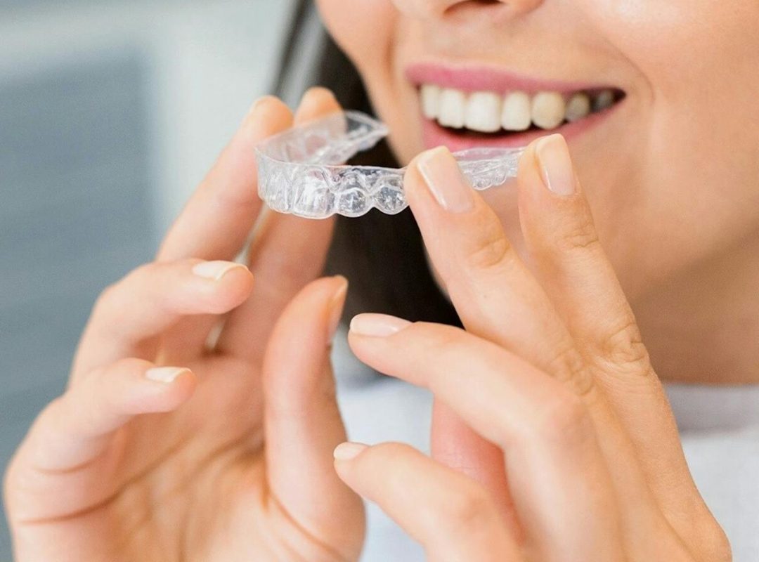 redresser et aligner ses dents